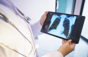 Lung Cancer in West Virginia: Preserving the Advance Premium Tax Credits is Crucial